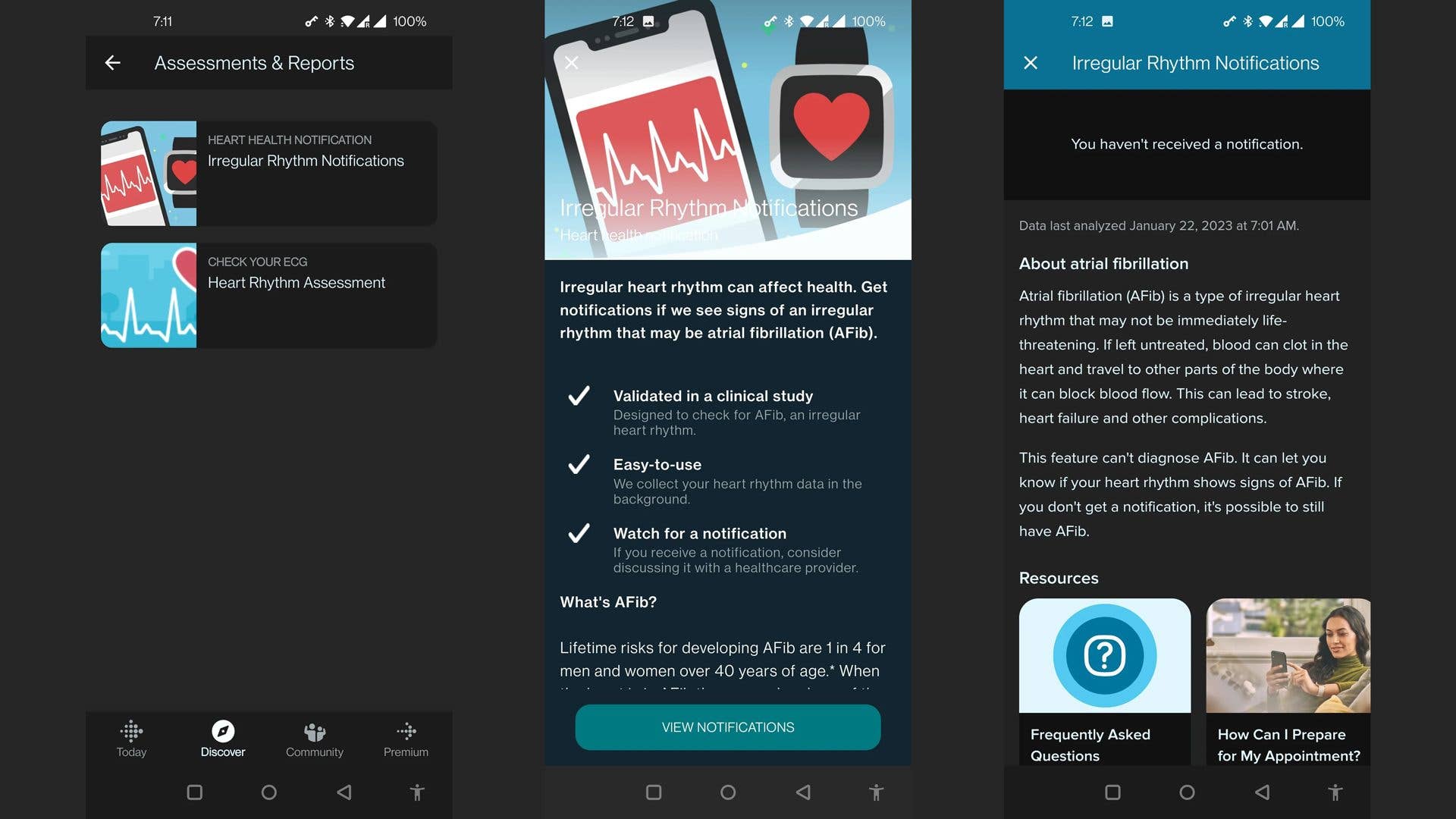 Screenshots zu den "Irregular Hear Rhythm"-Features auf der Pixel Watch