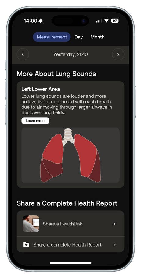Screenshot der Withings BeamO-App, die die Messung der Lungengeräusche und Optionen für Gesundheitsberichte zeigt.