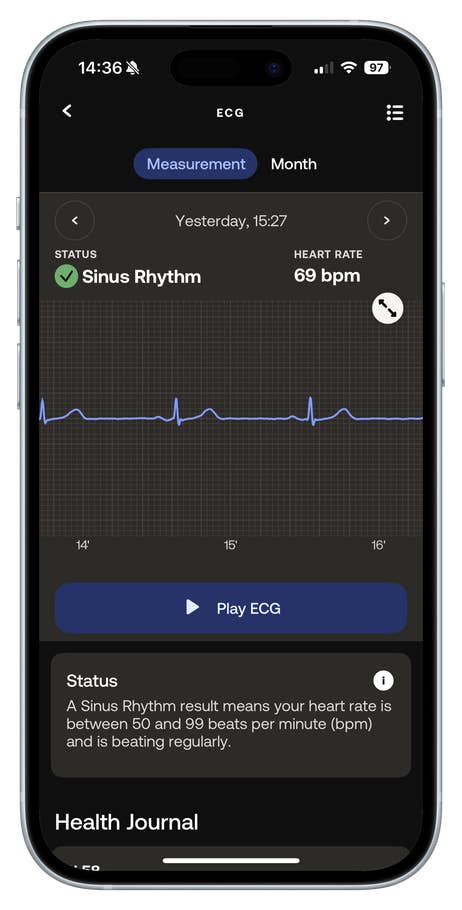 EKG-Ablesung auf einem Smartphone zeigt Sinusrhythmus und Herzfrequenz von 69 bpm.