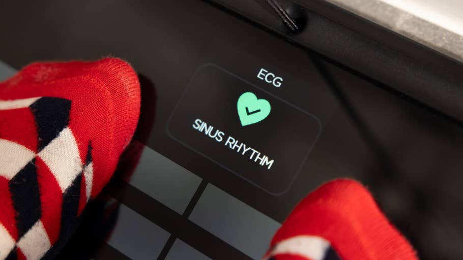 Füße in bunten Socken auf einem Gerät mit der Aufschrift „EKG“ und „SINUS RHYTHM“.